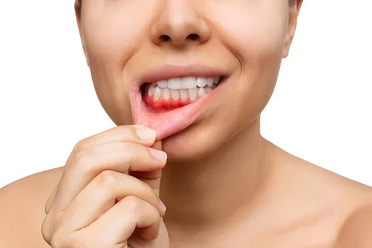 Lady with puffy gums