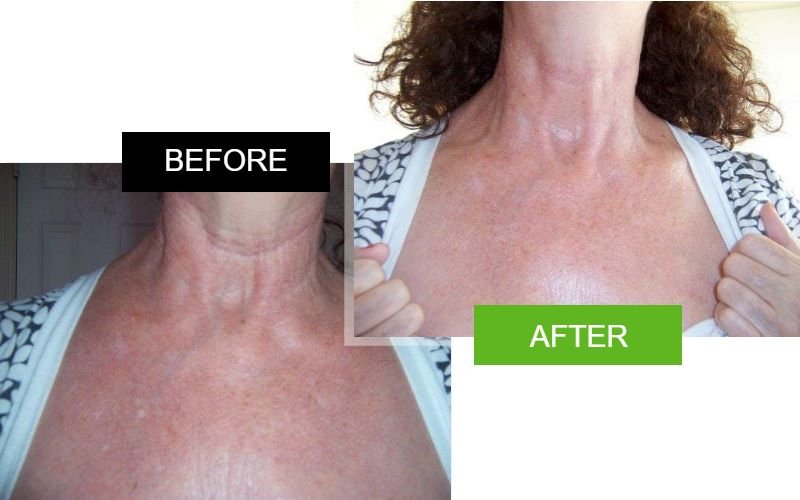 Visual guide to best anti aging serum