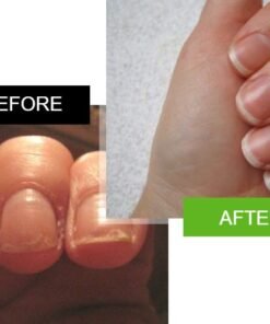 nails before and after 3