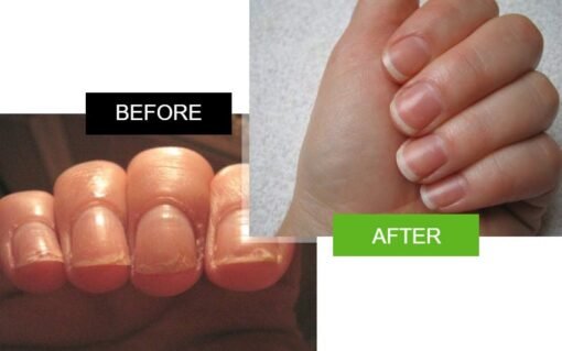 nails before and after 3