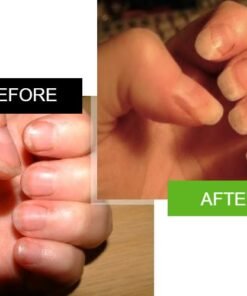 nails before and after 2