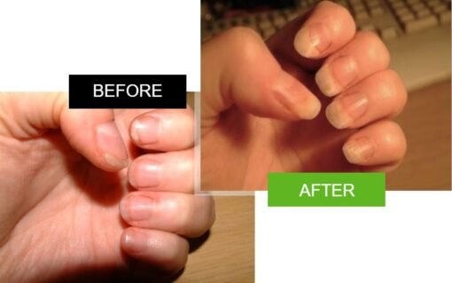 nails before and after 2