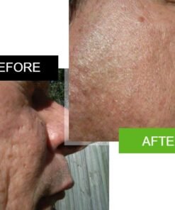 Sd7 Serum before and after 4